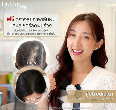 Slider image (7) The Best Medical Hair Center by Dr. Orn 
